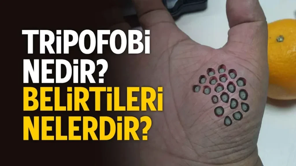 Ayaklarda ki Tripofobi