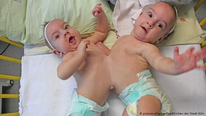 Doktorlar Gördüklerine İnanamadı! Ankara’da Doğan Bebek Herkesi Şoke Etti