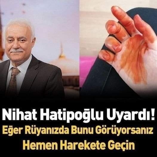 sabah uyandığında elinde kına olduğunu fakat bunu kendisinin yakmadığını söyledi