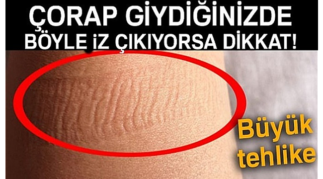 7 belirti